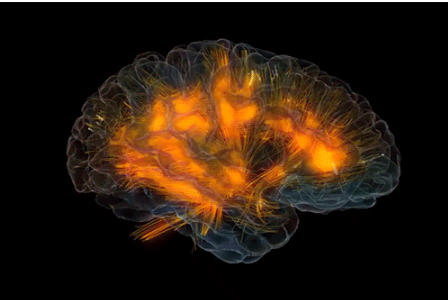 意识产生的器官，大脑的物质构成 ——伯凡杂谈 17